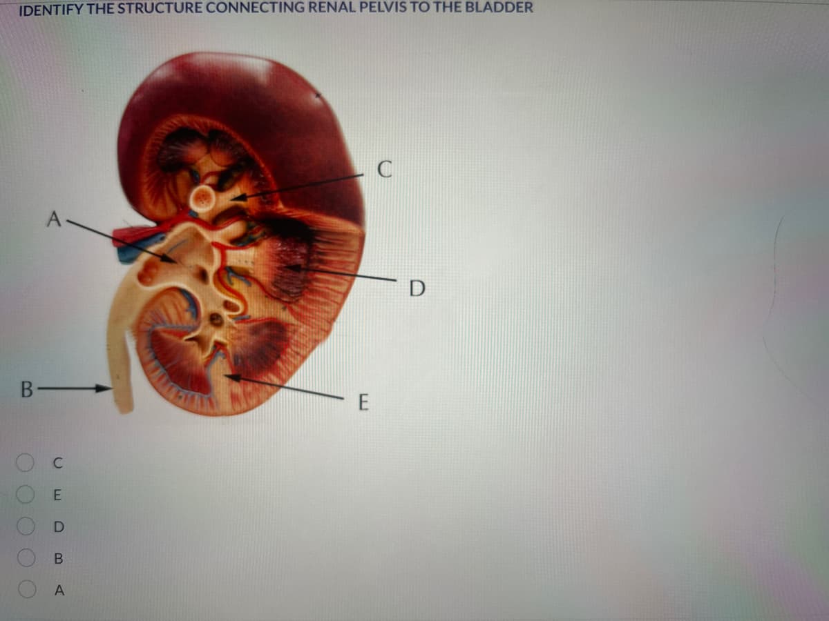 IDENTIFY THE STRUCTURE CONNECTING RENAL PELVIS TO THE BLADDER
B-
A
C
E
D
B
A
E
C
D